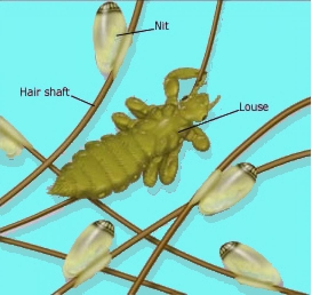Headlice 13 April 2018 Newsletter