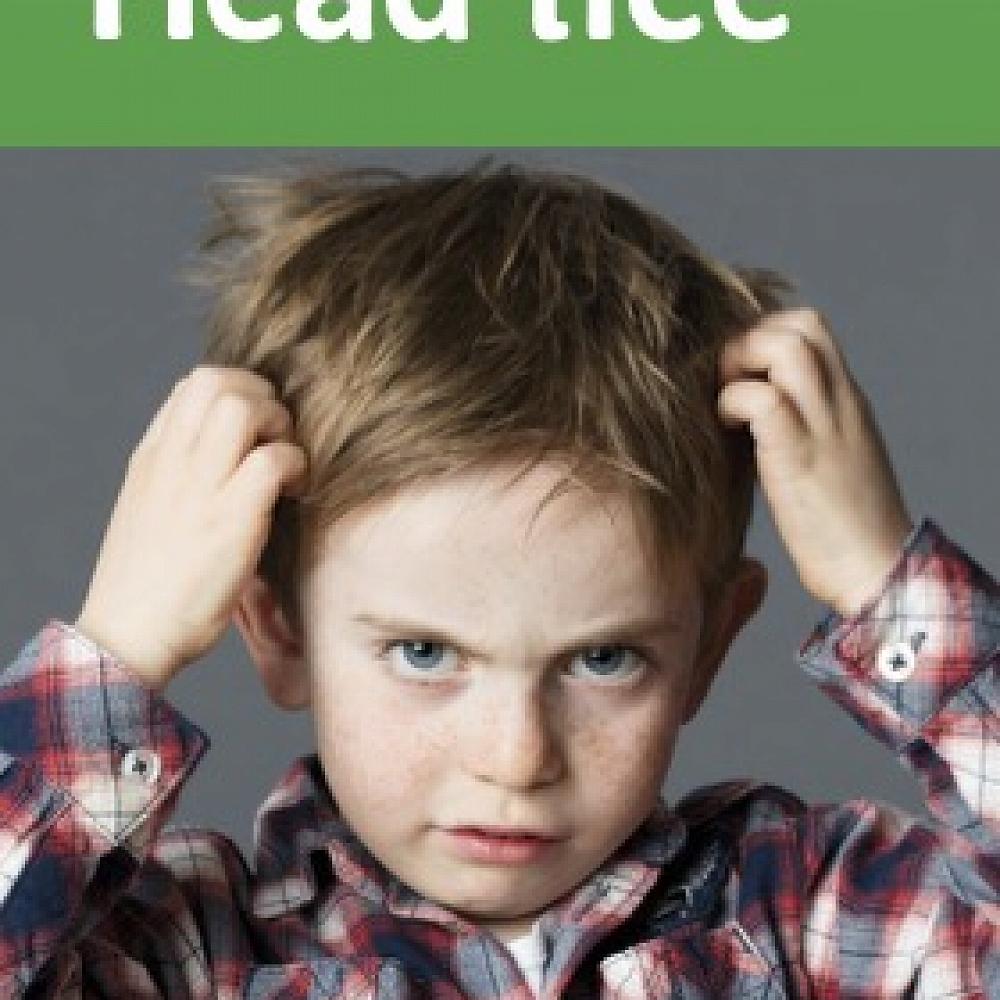 Head lice