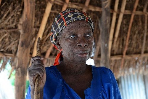 Mairige has been blinded by River Blindness.