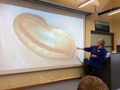 This is the sucker foot of a mollusc 