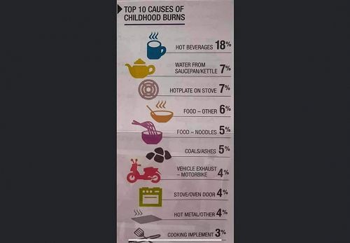 Top 10 causes of childhood burns