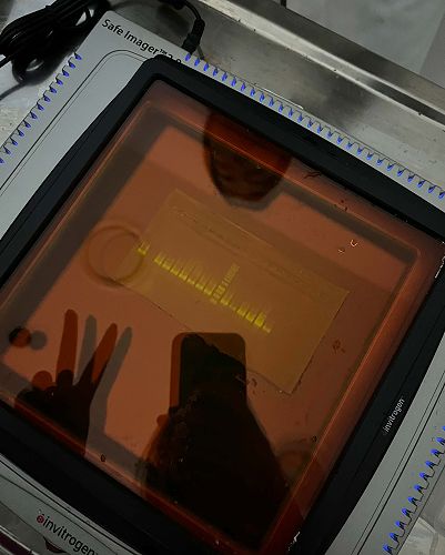 Gel electrophoresis