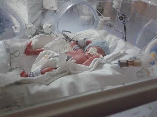 Nicks first day. Born at 24 weeks.