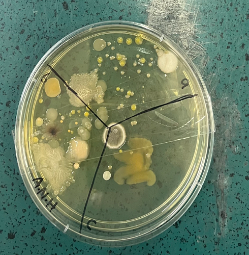 Foe: Petri dish showing fungus, yeast and bacteria present on hand railings, outside tables and door handles.